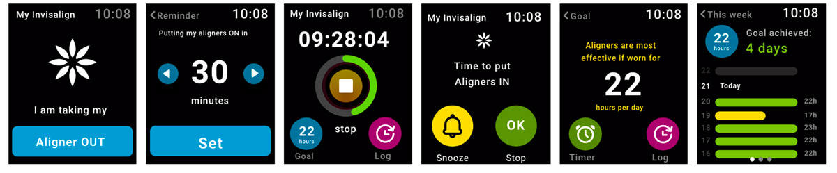 Align Technology