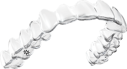 Invisalign aligner