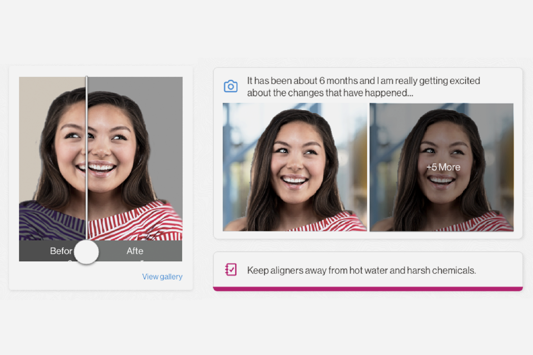 MyInvisalign Smile Gallery flow
